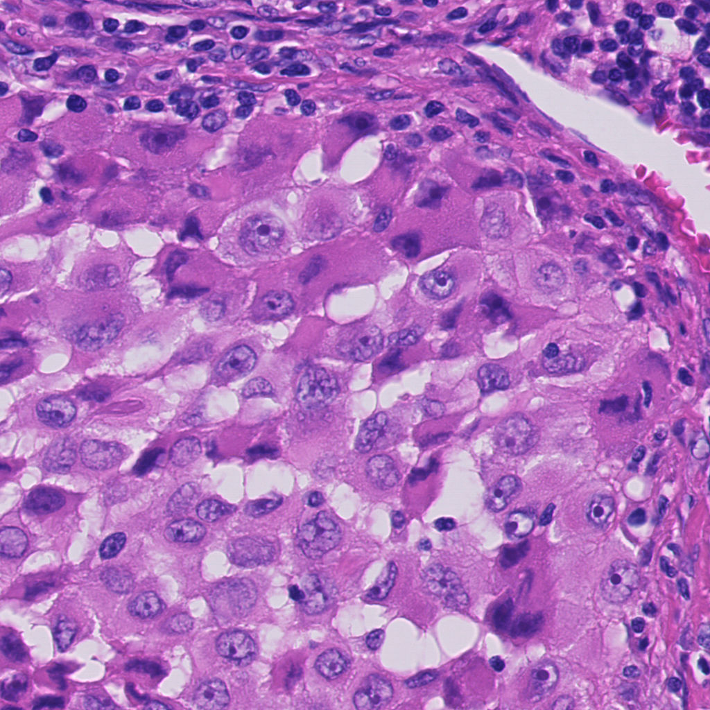 Original histopathology input patches
