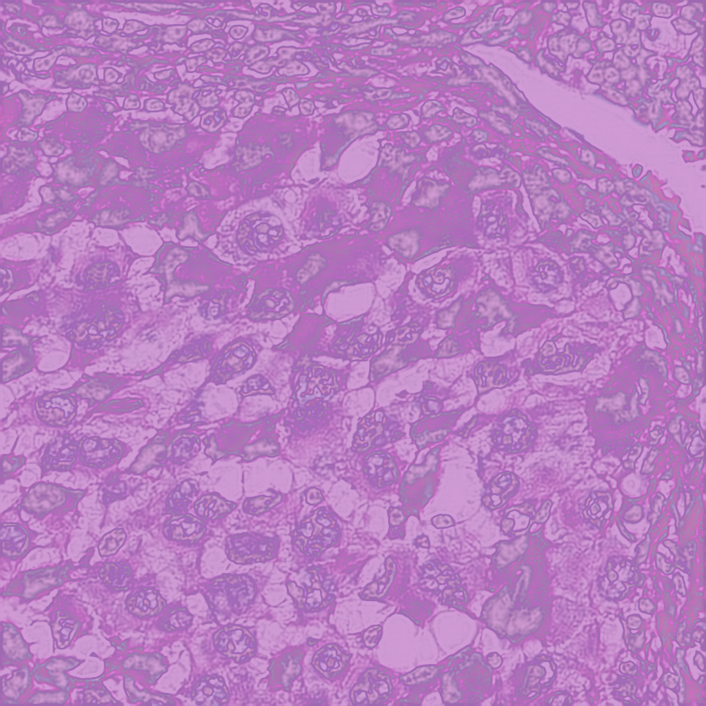 Autoencoder reconstructions of histopathology patches