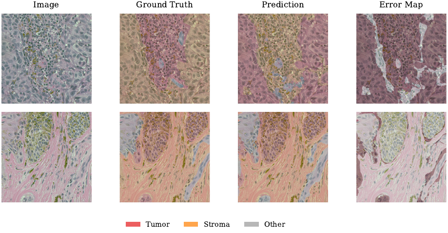 Best and worst U-Net tissue segmentation examples from the test set