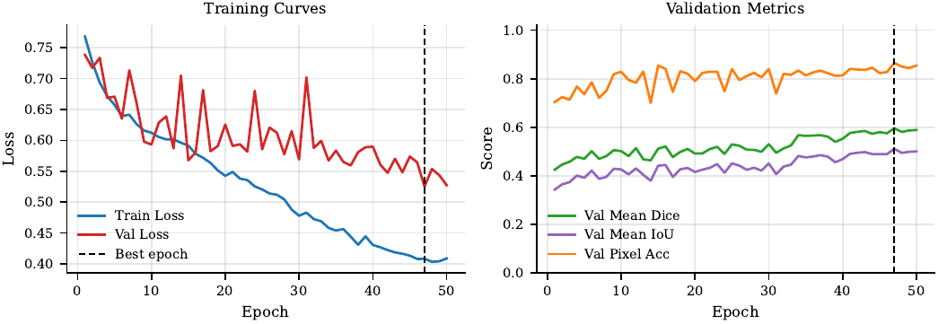 U-Net training and validation curves